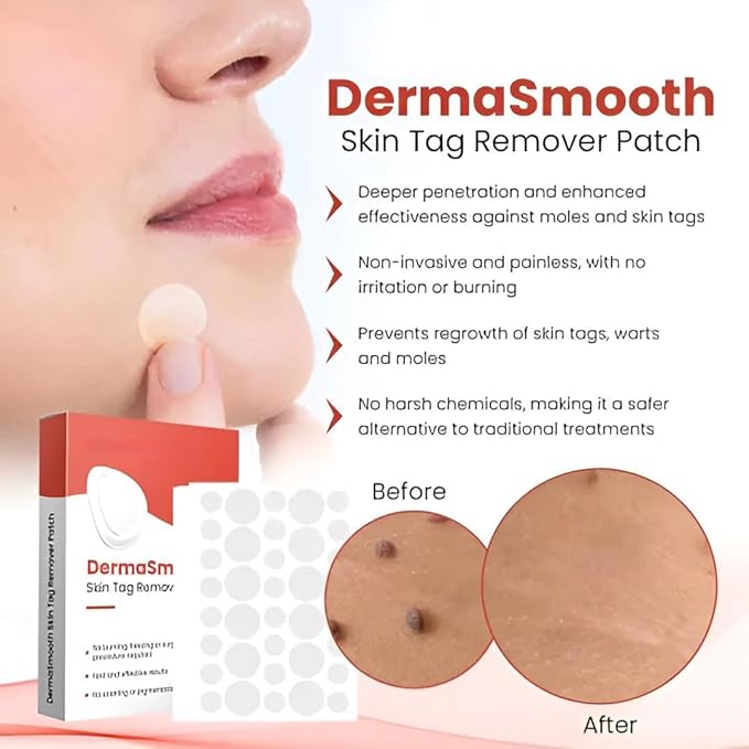 Skin Tag Remover Patch – Gentle & Painless Skin Care Solution 🎉 BUY 1 GET 1 FREE