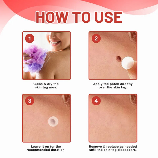Premium Skin Tag Removal Patch – Soft on Skin, Tough on Tags 💎 BUY 1 GET 1 FREE