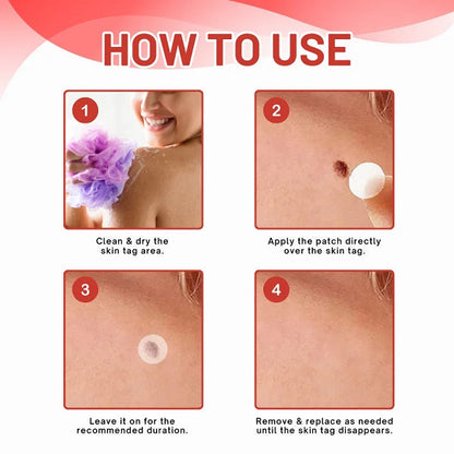 Premium Skin Tag Removal Patch – Soft on Skin, Tough on Tags 💎 BUY 1 GET 1 FREE