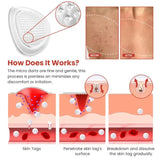 Skin Tag Remover Patch – Gentle & Painless Skin Care Solution 🎉 BUY 1 GET 1 FREE