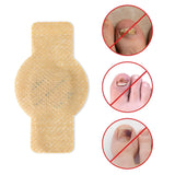 Nail Fungal Patches – Fast Nail Repair & Healthy Nail Care Patch 🔥 BUY 1 GET 1 FREE