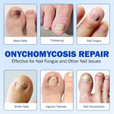 Nail Fungal Patches – Fast Nail Repair & Healthy Nail Care Patch 🔥 BUY 1 GET 1 FREE