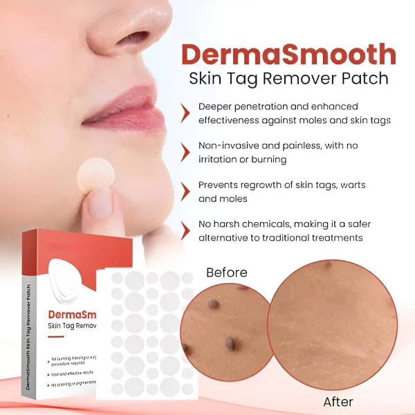 Premium Skin Tag Removal Patch – Soft on Skin, Tough on Tags 💎 BUY 1 GET 1 FREE