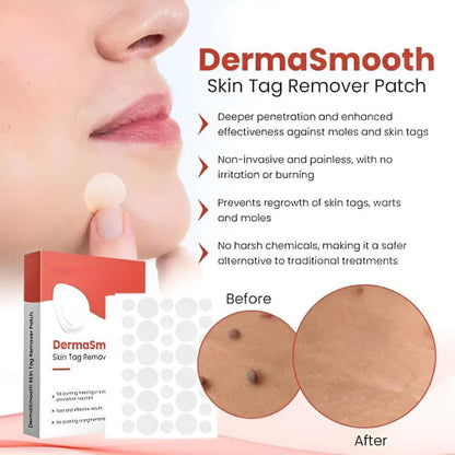 Premium Skin Tag Removal Patch – Soft on Skin, Tough on Tags 💎 BUY 1 GET 1 FREE