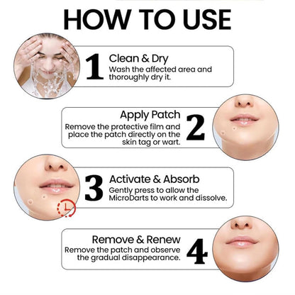 Premium Skin Tag Removal Patch – Soft on Skin, Tough on Tags 💎 BUY 1 GET 1 FREE
