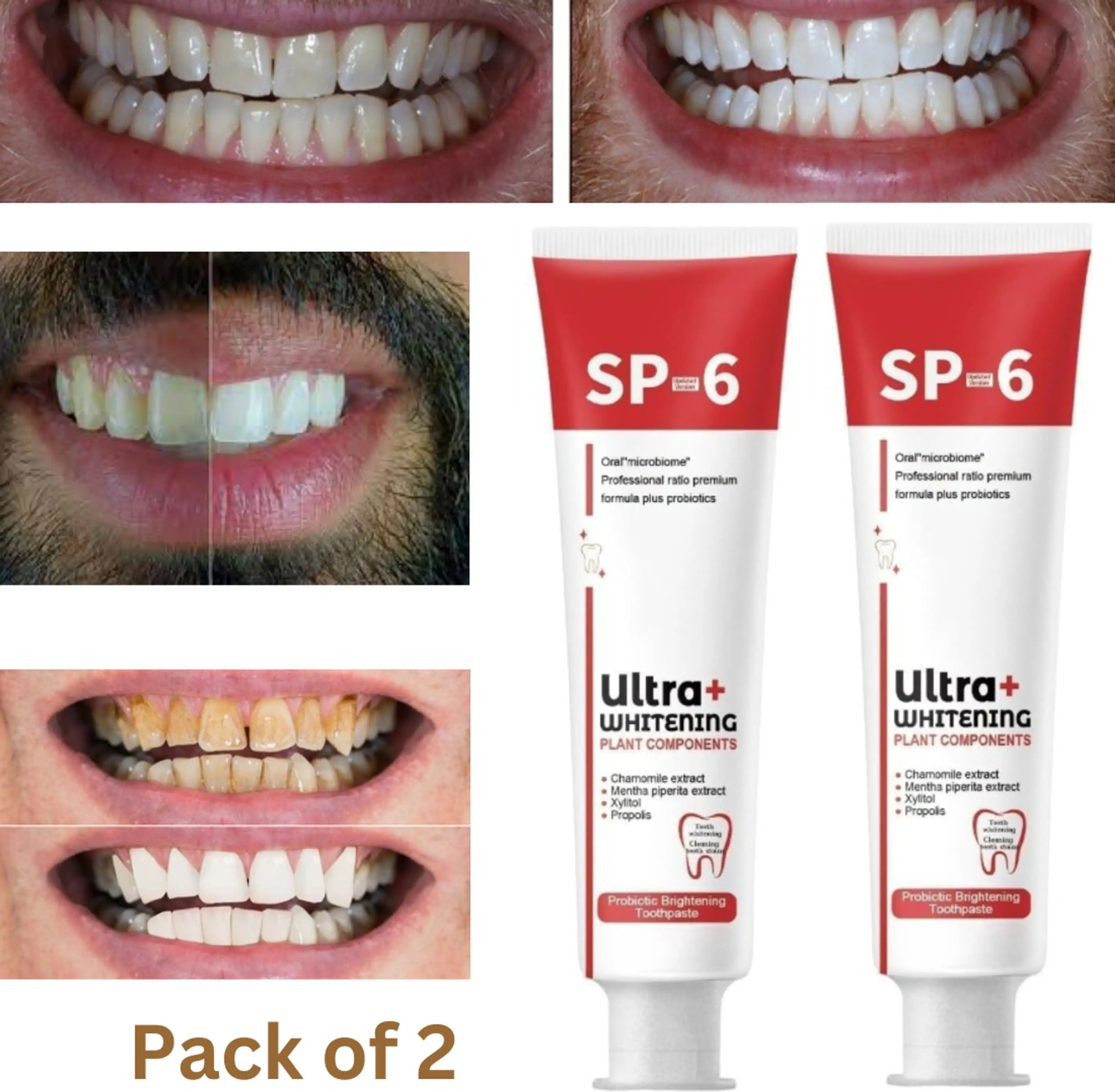 🦷 SP-6 Whitening Toothpaste | Probiotic Teeth Whitening for Stains, Bad Breath & Gum Health- ( Pack of 2)