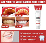 🦷 SP-6 Whitening Toothpaste | Probiotic Teeth Whitening for Stains, Bad Breath & Gum Health- ( Pack of 2)