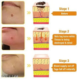 Skin Tag Remover Patch – Gentle & Painless Skin Care Solution 🎉 BUY 1 GET 1 FREE