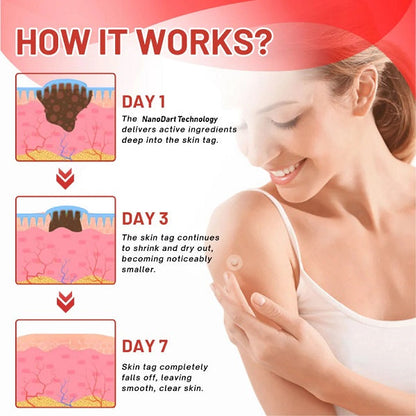 Premium Skin Tag Removal Patch – Soft on Skin, Tough on Tags 💎 BUY 1 GET 1 FREE