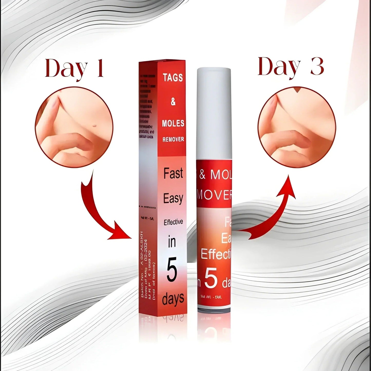 🌿 Skin Tag & Wart Care Cream – Smooth & Clear Looking Skin