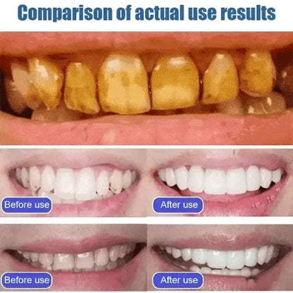🦷 SP-6 Whitening Toothpaste | Teeth Whitening for Stains, Brighten Your Smile & Keep Your Breath Fresh| BUY 1 GET 1 FREE 🎁