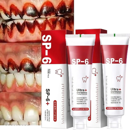 🦷 SP-6 Whitening Toothpaste | Probiotic Teeth Whitening for Stains, Bad Breath & Gum Health
